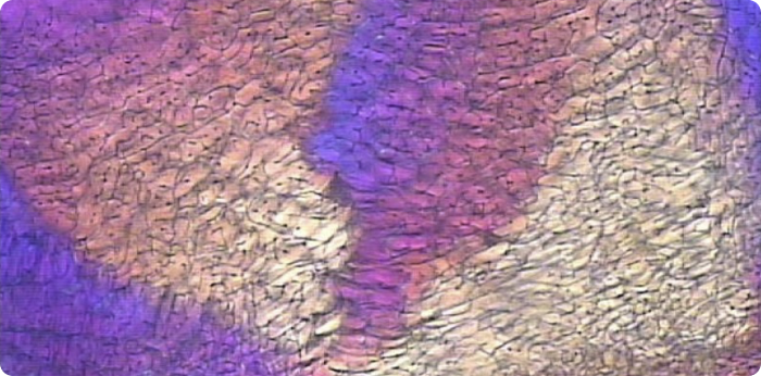 Frozen Formulation under FDM image