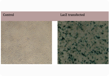 control and lacz transfected image