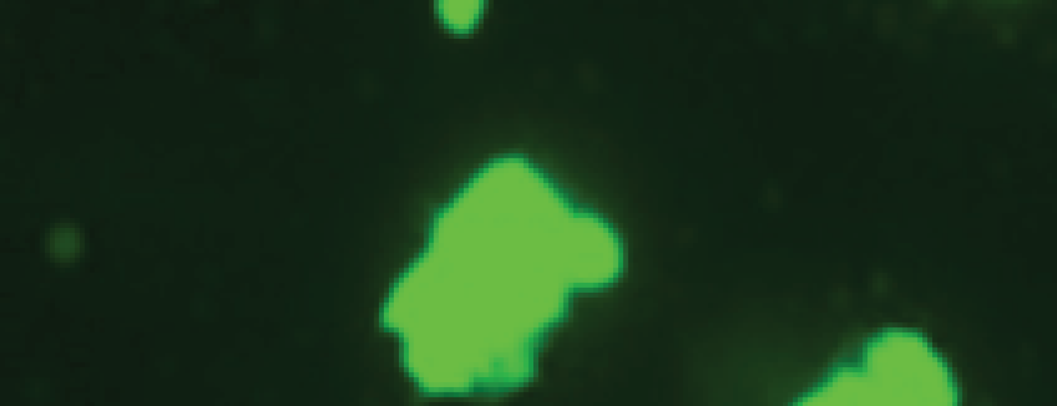 Fluorescence microscopy image displaying bright green glowing cells